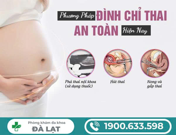 Hình ảnh minh họa